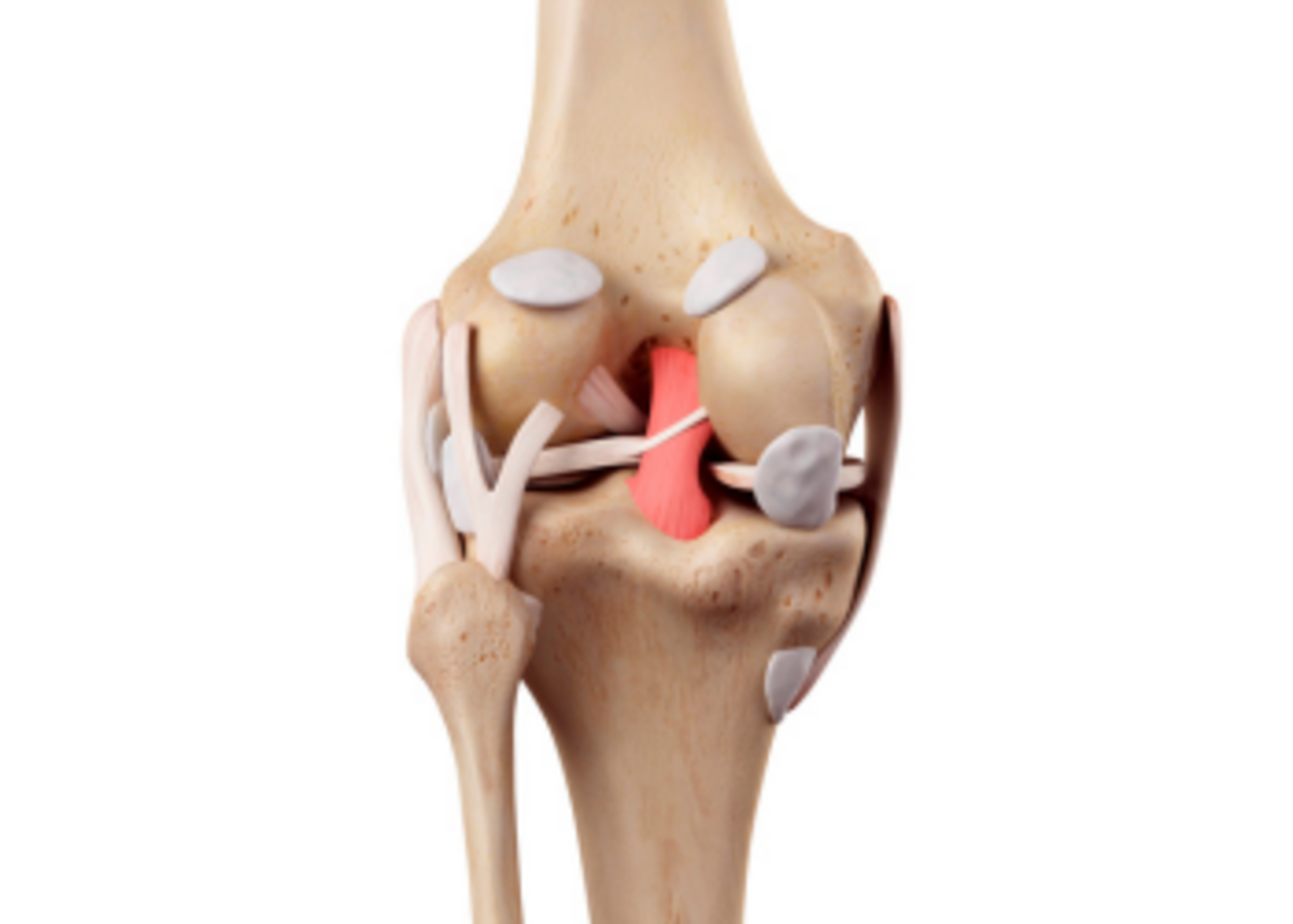 Ligament reconstruction